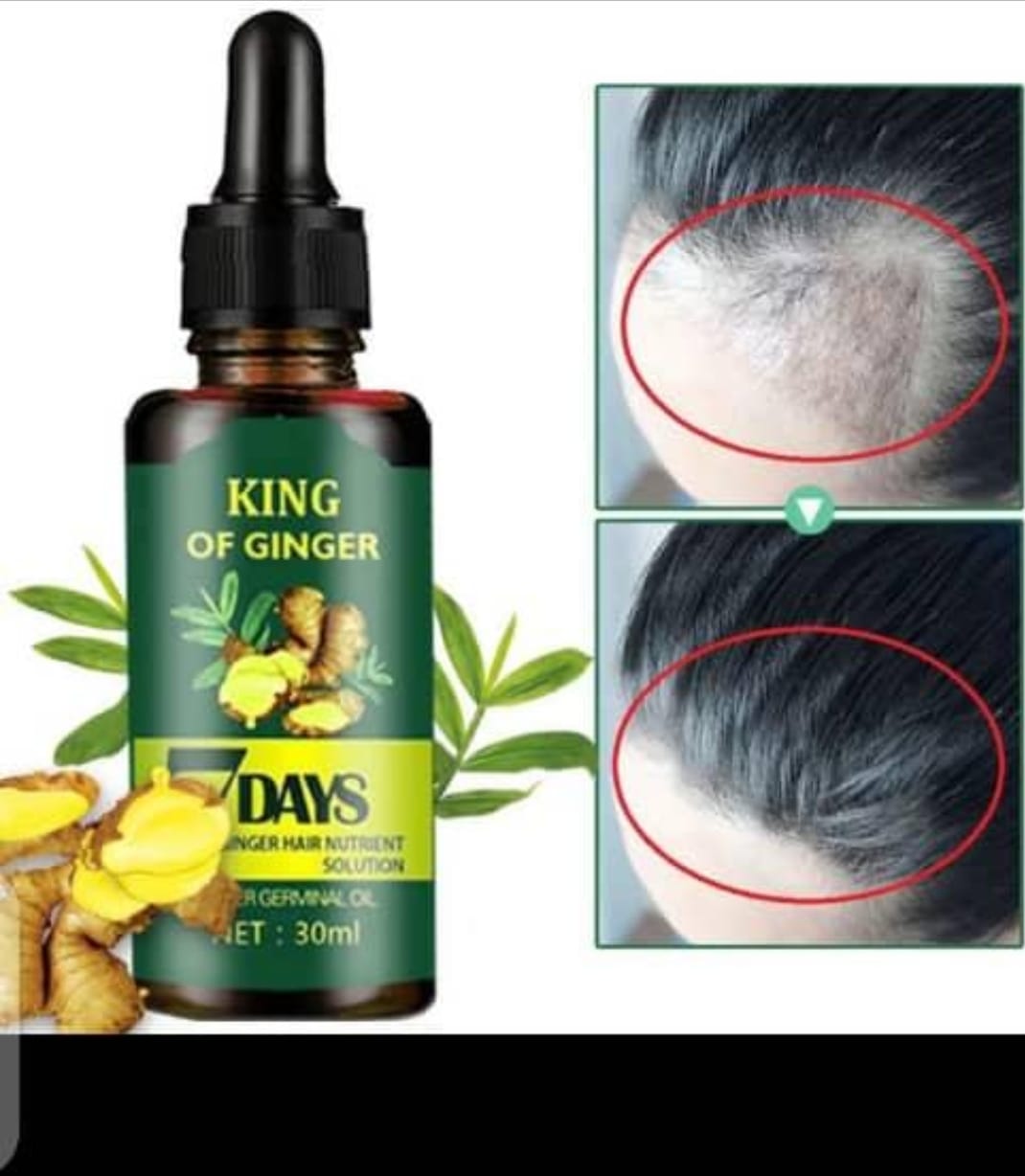 Huile Essentielle de Gingembre – Croissance & Fortification des Cheveux et de la Barbe