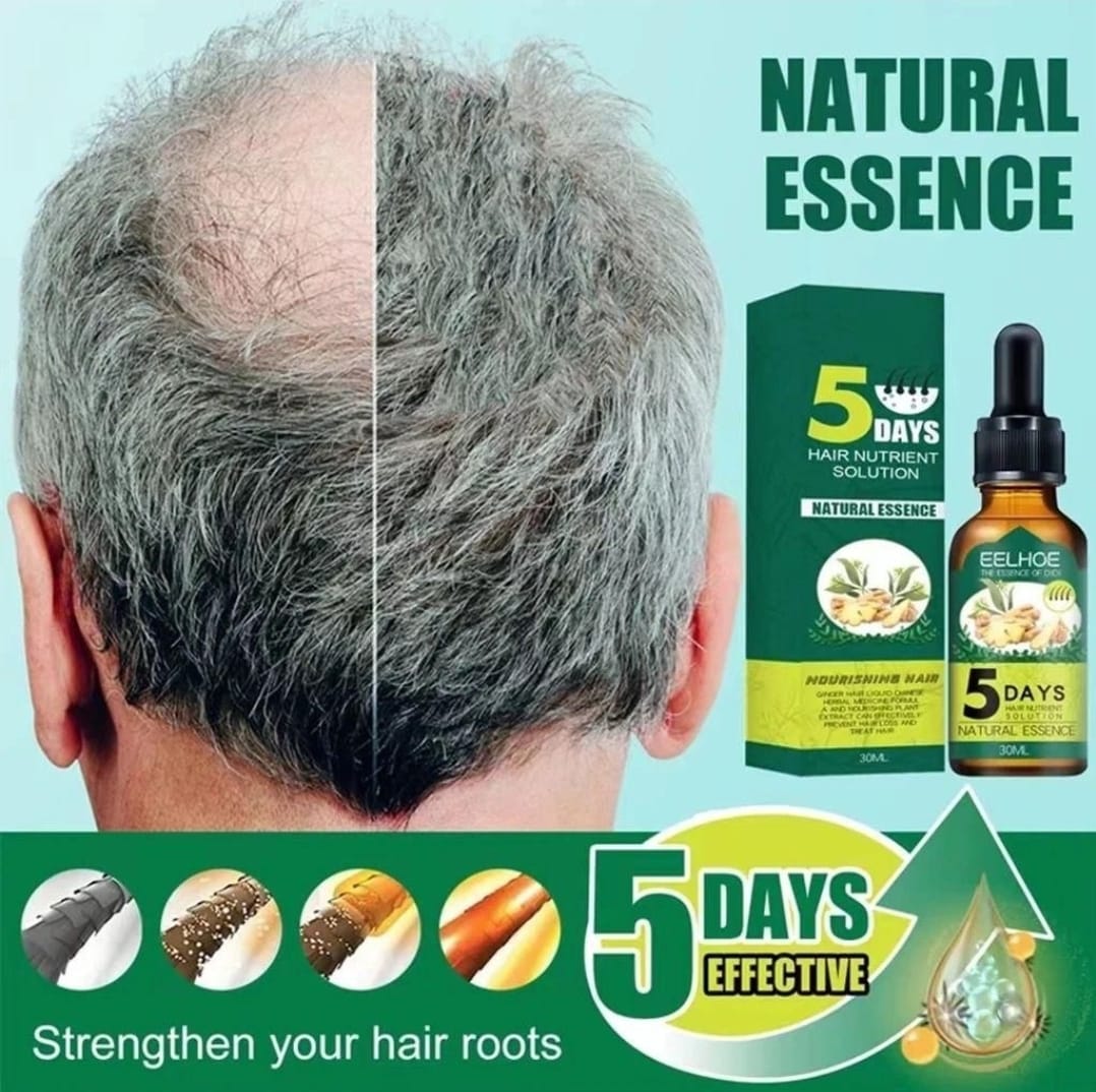 Huile Essentielle de Gingembre – Croissance & Fortification des Cheveux et de la Barbe