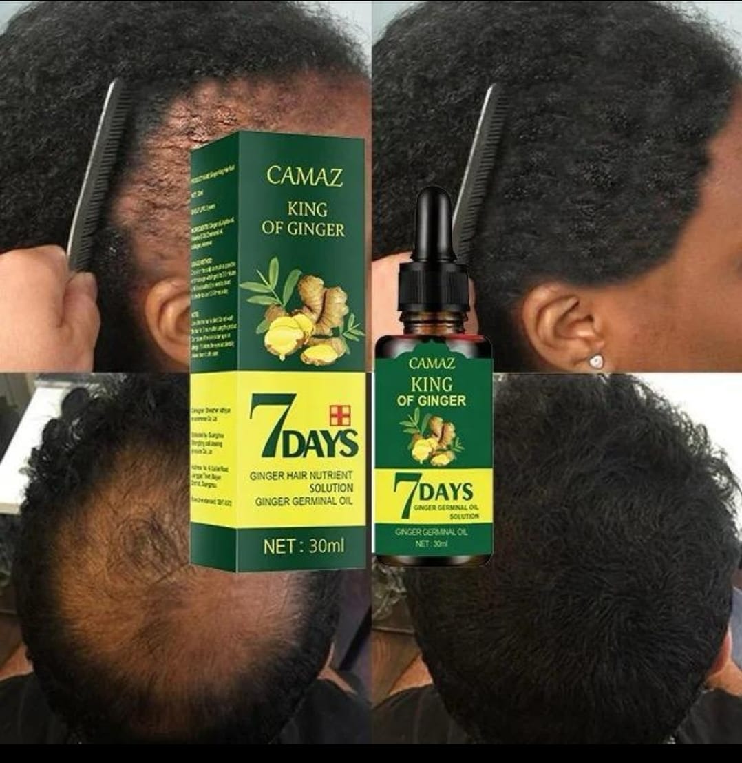 Huile Essentielle de Gingembre – Croissance & Fortification des Cheveux et de la Barbe