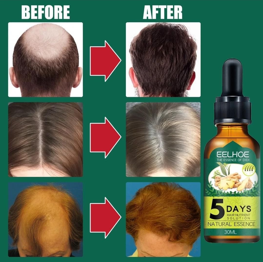Huile Essentielle de Gingembre – Croissance & Fortification des Cheveux et de la Barbe